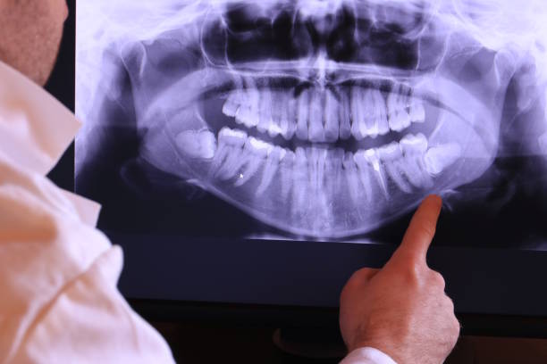 Best Urgent Care for Lost Fillings or Crowns in Santa Venetia, CA
