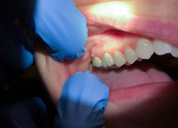 Best After-Hours Dental Trauma Care in Santa Venetia, CA